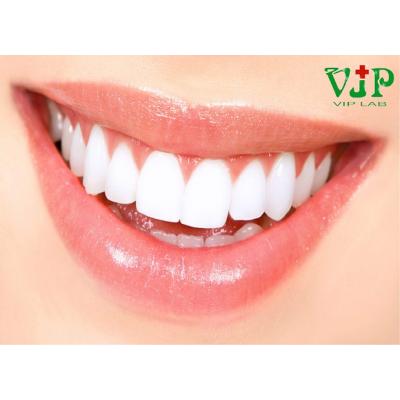 Khi nào nên bọc răng sứ? – Nha khoa VIPLAB