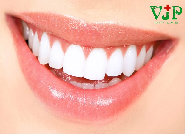 Khi nào nên bọc răng sứ? – Nha khoa VIPLAB